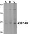 Ectodysplasin A2 Receptor antibody, AP05597PU-N, Origene, Western Blot image 