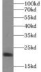 Interleukin 10 antibody, FNab04212, FineTest, Western Blot image 