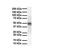 Colony Stimulating Factor 1 antibody, PA5-42558, Invitrogen Antibodies, Western Blot image 