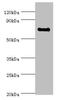 TATA-Box Binding Protein Associated Factor 5 Like antibody, orb352620, Biorbyt, Western Blot image 