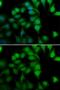 RNA Polymerase II Subunit H antibody, GTX65882, GeneTex, Immunocytochemistry image 