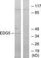 Sphingosine-1-Phosphate Receptor 2 antibody, TA314889, Origene, Western Blot image 