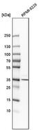 Biliverdin Reductase A antibody, NBP1-90757, Novus Biologicals, Western Blot image 