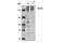 Coiled-Coil Domain Containing 88A antibody, 14200S, Cell Signaling Technology, Western Blot image 