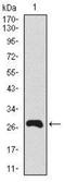 Short palate, lung and nasal epithelium carcinoma-associated protein 2 antibody, NBP2-37438, Novus Biologicals, Western Blot image 
