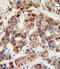 Ornithine Carbamoyltransferase antibody, A00721-2, Boster Biological Technology, Immunohistochemistry paraffin image 
