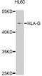 Major Histocompatibility Complex, Class I, G antibody, A10182, ABclonal Technology, Western Blot image 