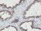 N-Myristoyltransferase 2 antibody, NBP2-01676, Novus Biologicals, Immunohistochemistry frozen image 