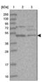 Phytanoyl-CoA 2-Hydroxylase Interacting Protein Like antibody, NBP1-84858, Novus Biologicals, Western Blot image 