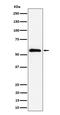 Bifunctional polynucleotide phosphatase/kinase antibody, M03566-1, Boster Biological Technology, Western Blot image 