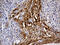 Mannose Receptor C Type 2 antibody, M04070, Boster Biological Technology, Immunohistochemistry paraffin image 