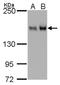 Rho Associated Coiled-Coil Containing Protein Kinase 1 antibody, MA5-27778, Invitrogen Antibodies, Western Blot image 