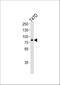 Exostosin Glycosyltransferase 2 antibody, A02065-1, Boster Biological Technology, Western Blot image 