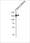 Ceruloplasmin antibody, LS-C100519, Lifespan Biosciences, Western Blot image 