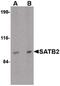 SATB Homeobox 2 antibody, PA5-20532, Invitrogen Antibodies, Western Blot image 