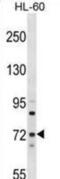 Myotubularin Related Protein 6 antibody, abx028890, Abbexa, Western Blot image 