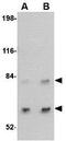 SATB Homeobox 2 antibody, GTX30894, GeneTex, Western Blot image 