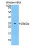 Myosin Heavy Chain 8 antibody, abx104488, Abbexa, Enzyme Linked Immunosorbent Assay image 