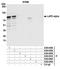 Thymopoietin antibody, A304-839A, Bethyl Labs, Immunoprecipitation image 