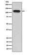 Insulin Degrading Enzyme antibody, M01358, Boster Biological Technology, Western Blot image 