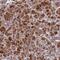 Armadillo Repeat Containing 6 antibody, NBP1-81179, Novus Biologicals, Immunohistochemistry frozen image 