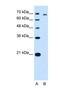 Threonyl-TRNA Synthetase antibody, NBP1-55369, Novus Biologicals, Western Blot image 