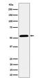 Ectonucleotide Pyrophosphatase/Phosphodiesterase Family Member 5 antibody, M14956, Boster Biological Technology, Western Blot image 