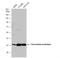 Thromboxane A Synthase 1 antibody, NBP1-31739, Novus Biologicals, Western Blot image 