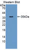 Plasmalemma Vesicle Associated Protein antibody, LS-C373577, Lifespan Biosciences, Western Blot image 