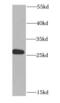 Mitochondrial Translational Initiation Factor 3 antibody, FNab05405, FineTest, Western Blot image 