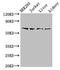 TXK Tyrosine Kinase antibody, CSB-PA025362LA01HU, Cusabio, Western Blot image 