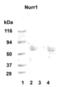 Nuclear Receptor Subfamily 4 Group A Member 2 antibody, NB110-40415, Novus Biologicals, Western Blot image 