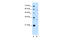 CD36 Molecule antibody, 30-355, ProSci, Enzyme Linked Immunosorbent Assay image 