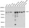Methylmalonyl-CoA Mutase antibody, GTX64725, GeneTex, Western Blot image 