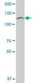 SET Domain Bifurcated Histone Lysine Methyltransferase 1 antibody, H00009869-M07, Novus Biologicals, Western Blot image 