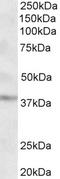 Growth Hormone Inducible Transmembrane Protein antibody, STJ72129, St John