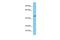 T-box transcription factor TBX20 antibody, PA5-40669, Invitrogen Antibodies, Western Blot image 