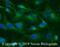 ISG-54 K antibody, NBP2-15180, Novus Biologicals, Immunocytochemistry image 