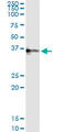 Corticotropin Releasing Hormone Binding Protein antibody, LS-C196965, Lifespan Biosciences, Immunoprecipitation image 