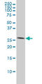 Acidic Nuclear Phosphoprotein 32 Family Member A antibody, LS-B6170, Lifespan Biosciences, Western Blot image 