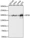 Eukaryotic Translation Initiation Factor 5B antibody, LS-C750095, Lifespan Biosciences, Western Blot image 