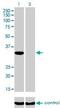 Inositol-tetrakisphosphate 1-kinase antibody, H00003705-M01, Novus Biologicals, Western Blot image 