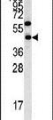 Ly1 Antibody Reactive antibody, PA5-14213, Invitrogen Antibodies, Western Blot image 