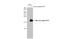 Insulin Like Growth Factor 2 antibody, GTX129110, GeneTex, Western Blot image 