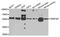 TERF2 Interacting Protein antibody, A7981, ABclonal Technology, Western Blot image 
