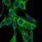 Actin Alpha 2, Smooth Muscle antibody, GTX60393, GeneTex, Immunocytochemistry image 