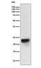 Follicle Stimulating Hormone Subunit Beta antibody, M01885-3, Boster Biological Technology, Western Blot image 