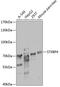 Syntaxin Binding Protein 4 antibody, A08343, Boster Biological Technology, Western Blot image 