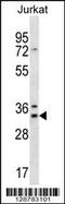 DnaJ Heat Shock Protein Family (Hsp40) Member C9 antibody, 56-746, ProSci, Western Blot image 