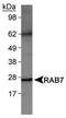 RAB7A, Member RAS Oncogene Family antibody, PA5-22959, Invitrogen Antibodies, Western Blot image 